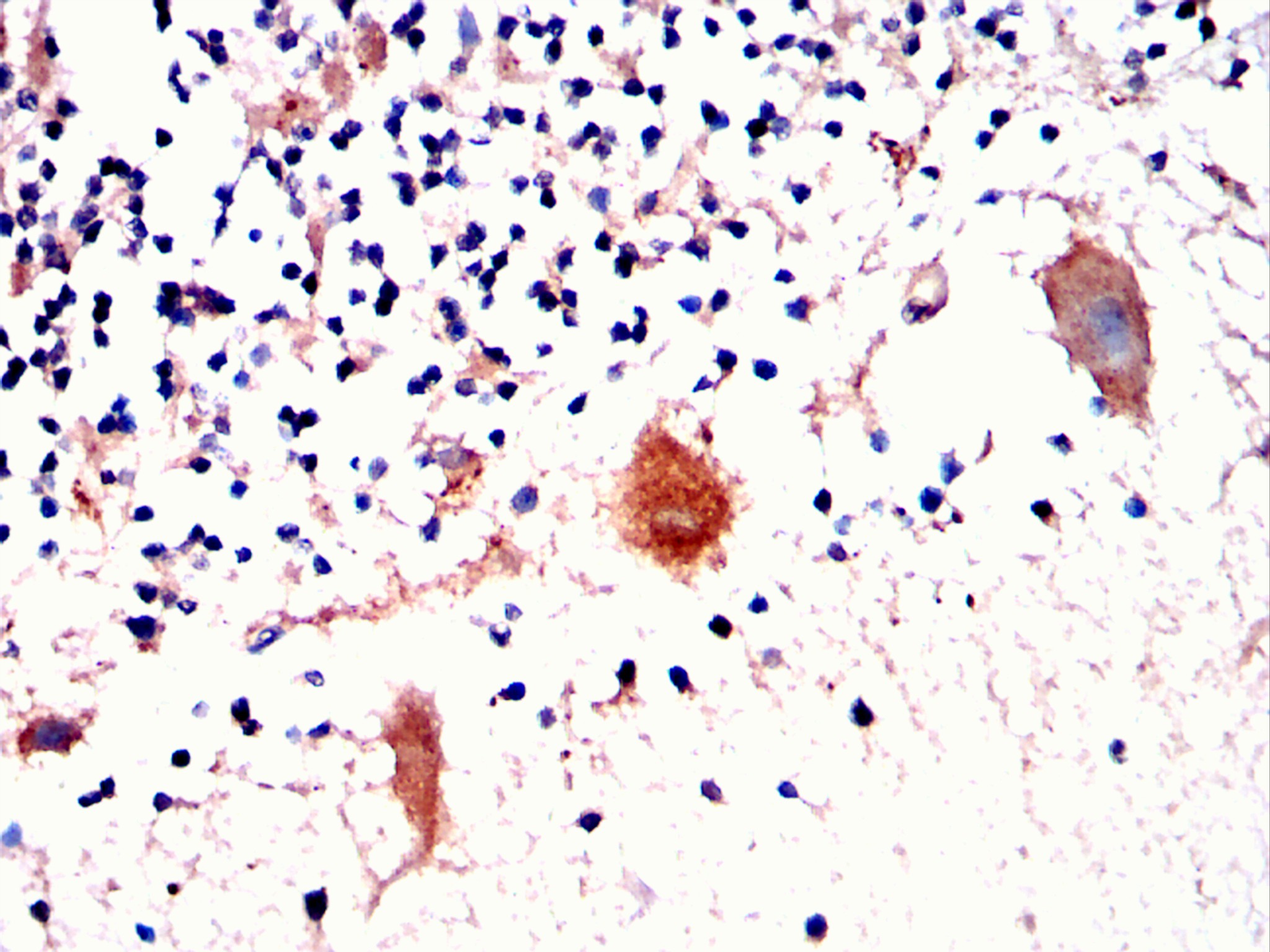                         IHC